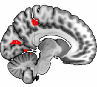 brain
